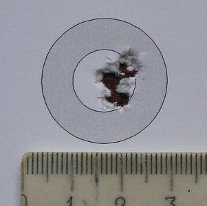 click for enlarge 1037 X 1031 136,8 Kb picture